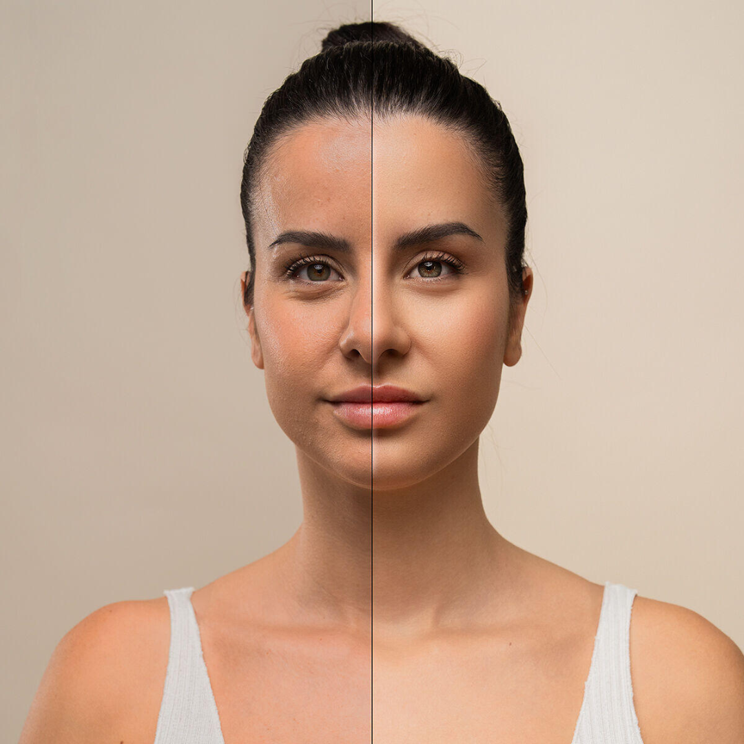 masajeador Facial Eléctrico Reafirmante para Cara y Cuello con LED, EMS y Calor Selora