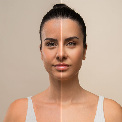 masajeador Facial Eléctrico Reafirmante para Cara y Cuello con LED, EMS y Calor Selora